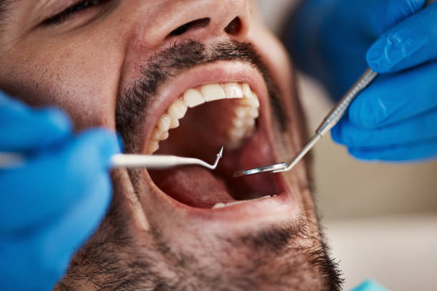 Best Emergency Treatment for Dental Infections or Abscesses in Mvell, AR